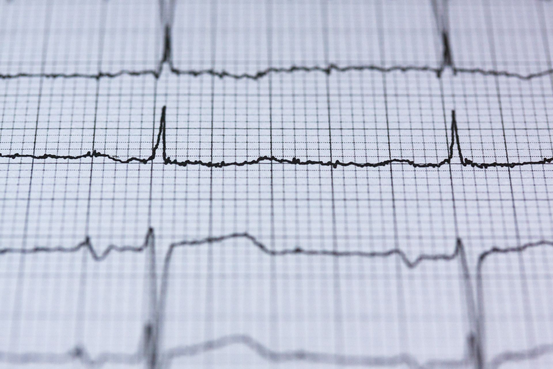 High cholesterol levels (Image sourced via Pexels / Photo by Pixabay)